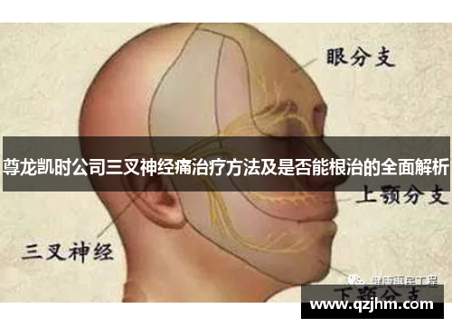 尊龙凯时公司三叉神经痛治疗方法及是否能根治的全面解析